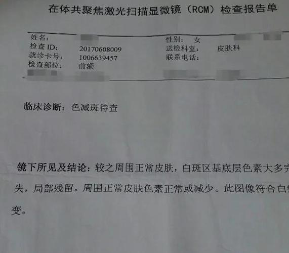 屏幕出现白点亮光是什么原因