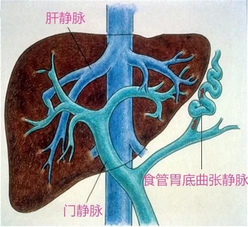 TIPS医学名词解释截图3
