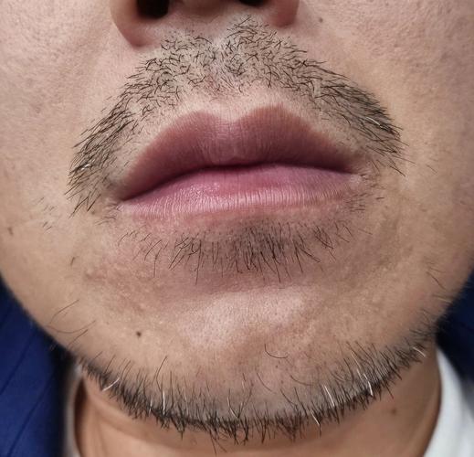 为什么自己长出的胡子是白色的
