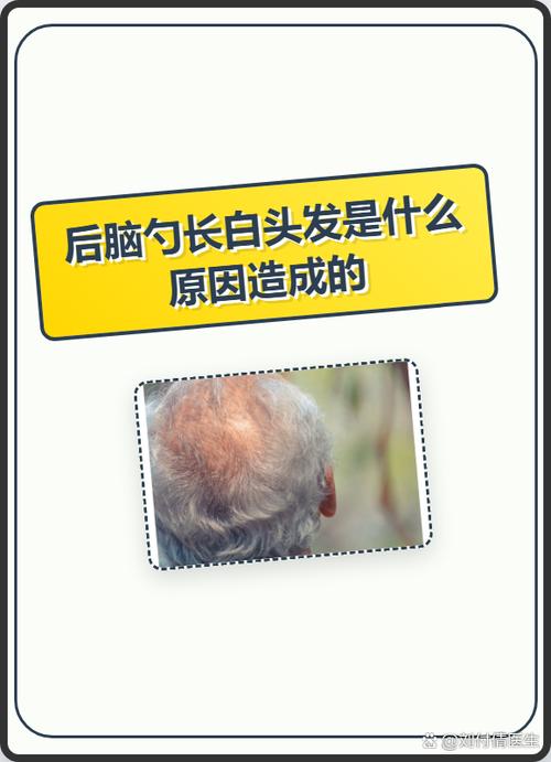 拍照头发为什么是白色的