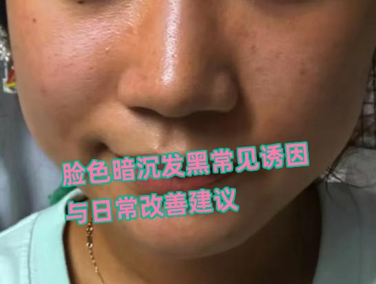 脸色暗黄发黑是什么原因