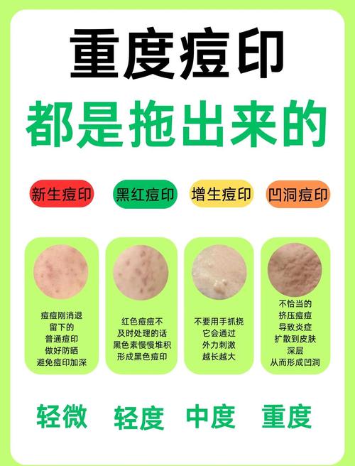 壁纸有脏印怎么办