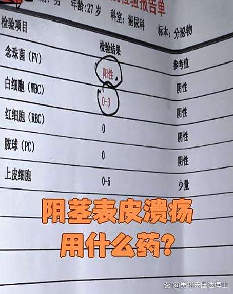 龟沟溃疡用什么药截图3