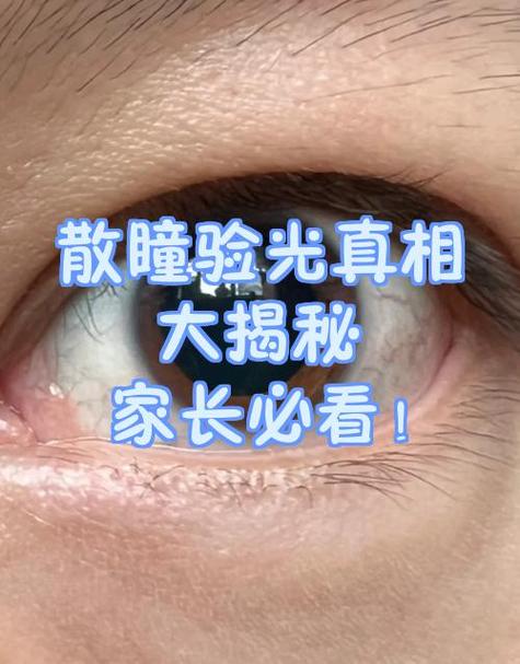 散瞳验光能不能下午做