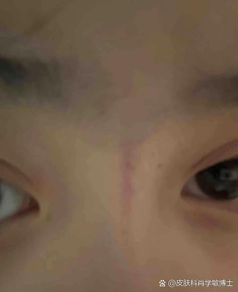 手机屏幕有一条紫色竖线