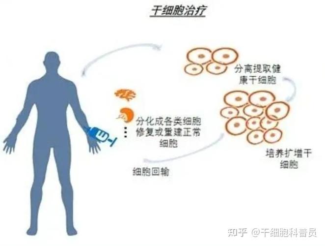 干细胞可以治疗哪些疾病