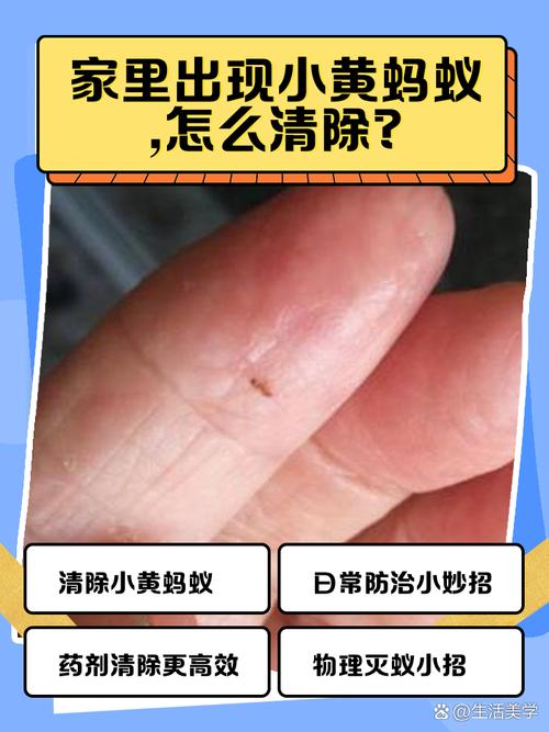 怎么样删除蚂蚁森林中的好友