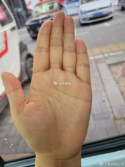 中指下有好多小竖线纹