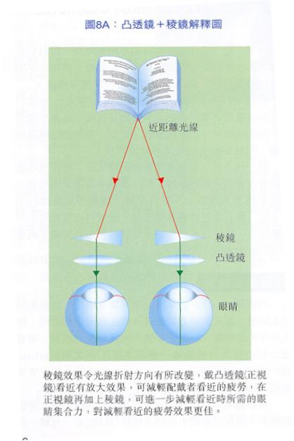 眼睛出现雾视是什么原因