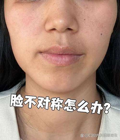脸部大小不对称的原因