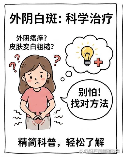 妇科白斑的最佳治疗方法
