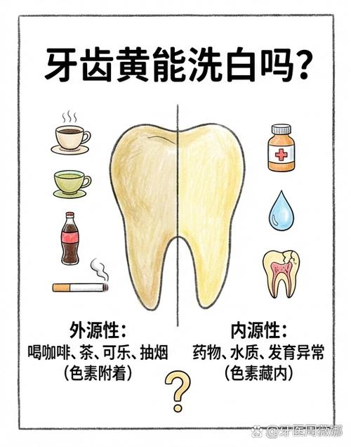 牙齿黄怎么洗白最快方法