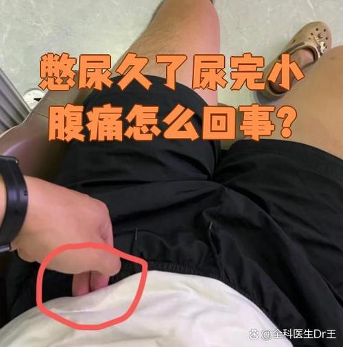 憋尿久了会出现什么症状
