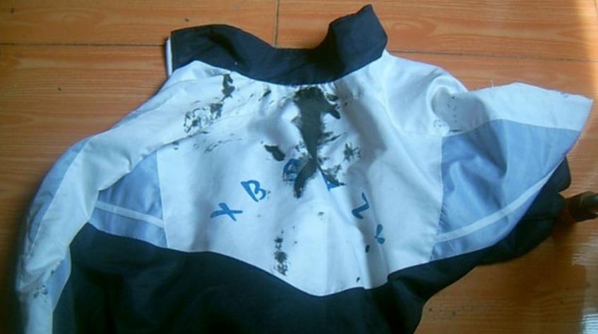 校服上的笔墨顽固污渍怎么去除