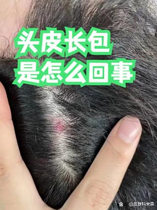 头上长红包是什么原因造成的