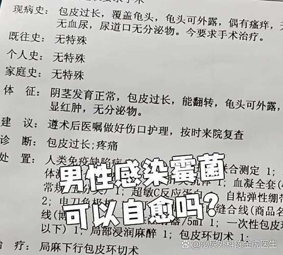 霉菌感染男性能自愈吗