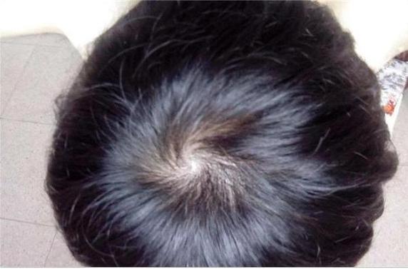 两个漩涡的女孩命好不好