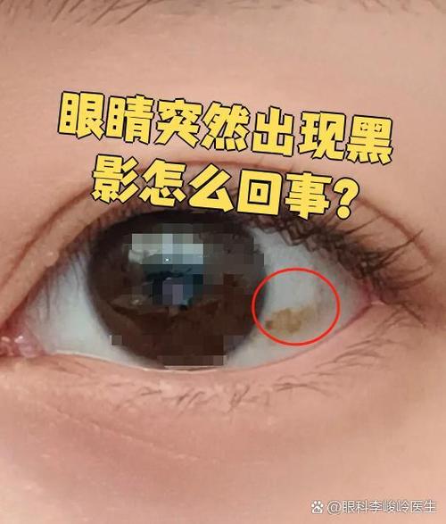 眼睛突然一黑
