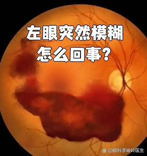 有时候突然眼睛模糊看不清