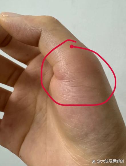 手指关节疼痛的原因和解决方法