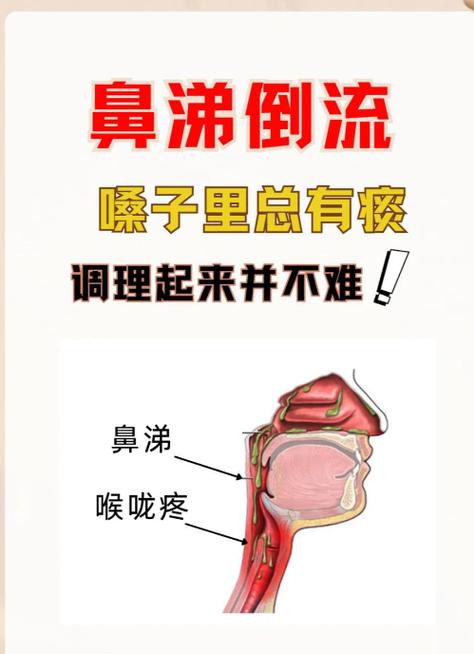 鼻窦炎是大病还是小病