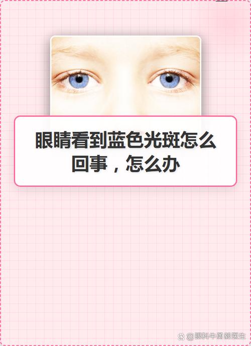 看了闪光灯后有眼睛光斑