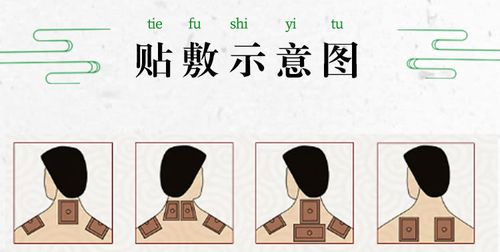 骨乐贴