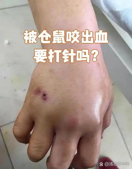 被仓鼠咬了会感染人吗