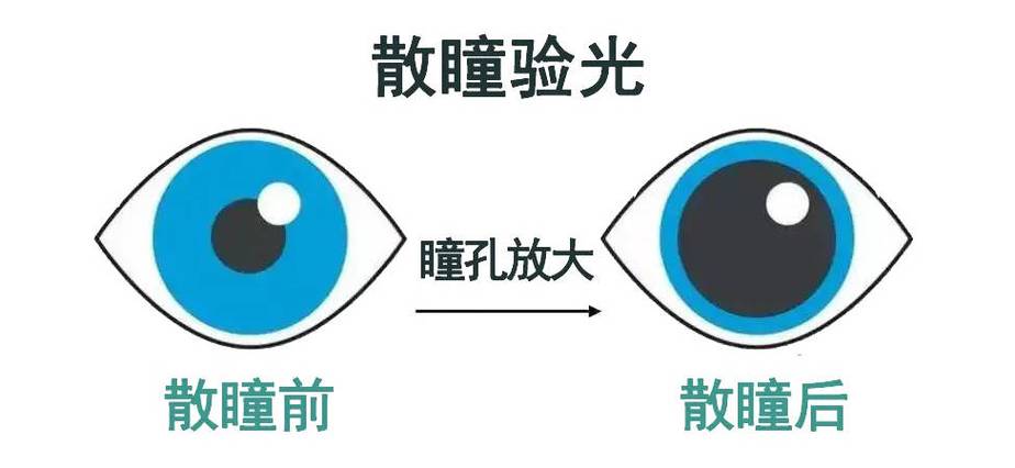 多大年龄验光不用散瞳
