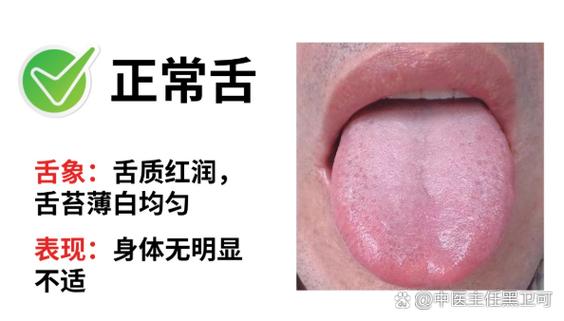 舌根起红泡是什么原因