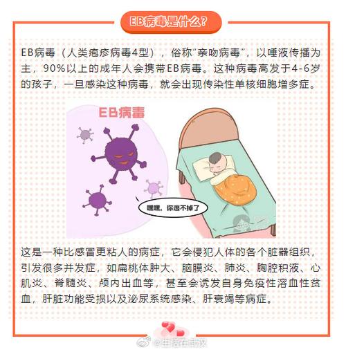 大人感染eb病毒怎么办