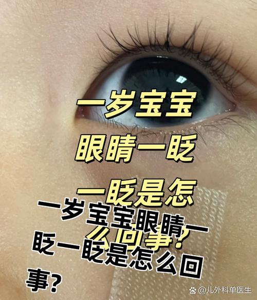 小孩的眼睛总是眨是怎么回事