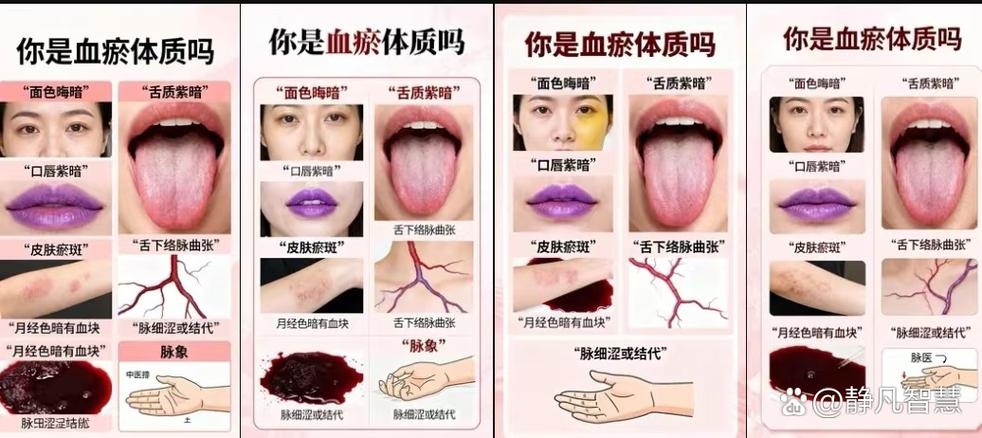 紫脉强度排名一览表