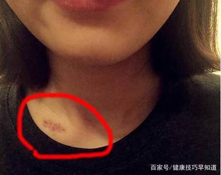 怎么在爱人身上留永久印记