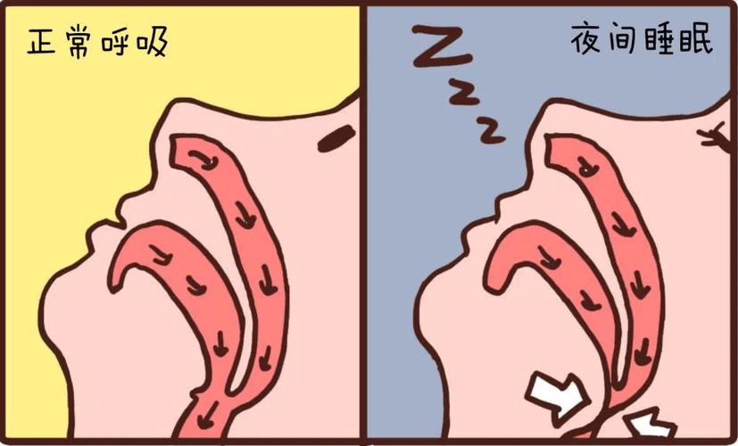 人为什么会打呼噜