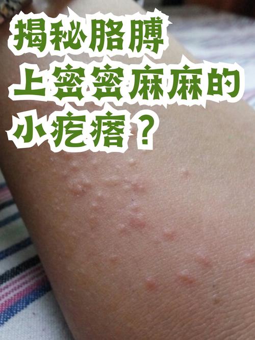 胳膊很痒一抓就出现好多小疙瘩