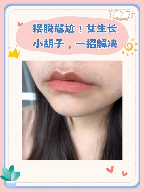 为什么女生会长出白色的胡子