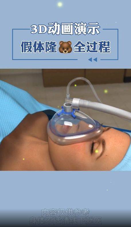 女生的胸长什么样子做手术视