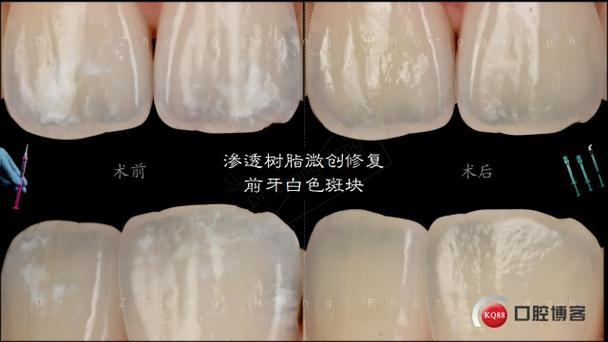 电视机屏幕有白色亮斑