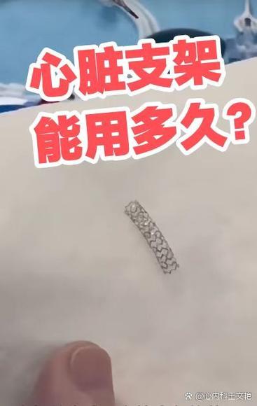 60岁放支架一般寿命