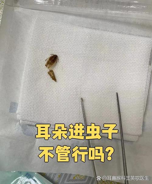 耳朵里进虫子没动静了截图3