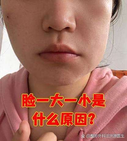 脸突然变得一边大一边小
