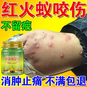 咬伤用什么药好得快