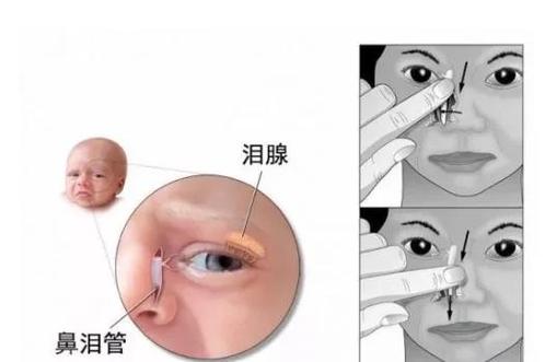 小孩的眼睛水汪汪的是怎么回事截图3