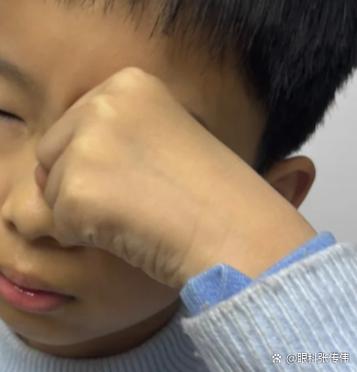 孩子看电视会近视眼吗