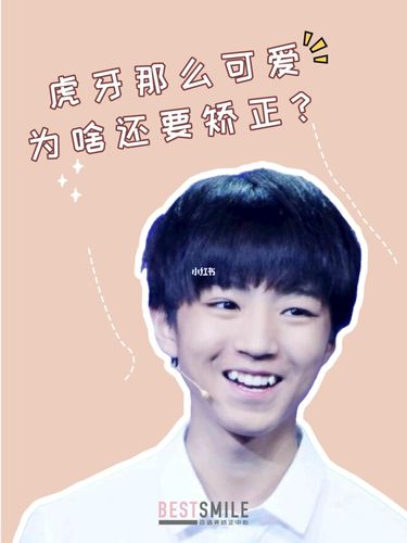 笔记本看虎牙直播卡顿