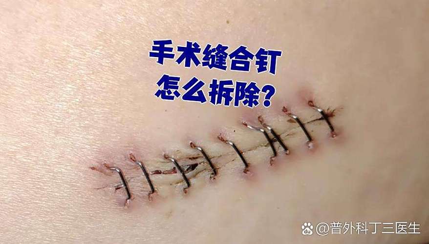 钉进去的钉子怎么取下来