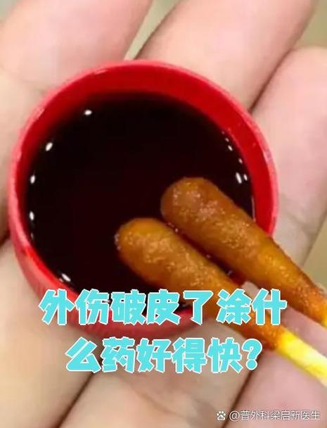 咬伤伤口用什么药愈合的快