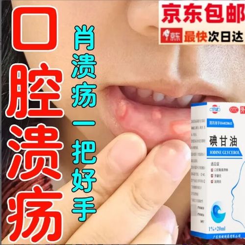 口腔溃疡最好的消炎药