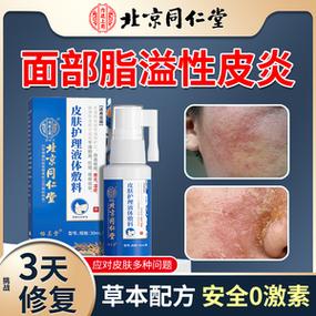 鼻翼两侧长癣起皮屑